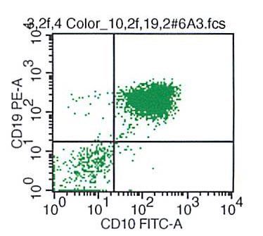 CD19 vs CD10